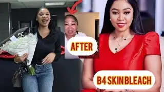 Ayanda Ncwane’s new face 💔😭congratulations Umiey Dreamz bought a brand new car 