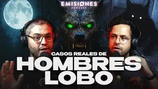 Casos REALES de HOMBRES LOBO