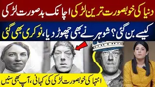 Duniya Ki Khubsurat Larki Achanak Badsurat Kaise Ban Gai? | Anee Faisal Vlog
