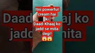 Itni Powerful Cream Hai Ki Daad-Khaaj Ko Jadd Se Mita Degi | Panderm ++ Cream Uses in Hindi #shorts