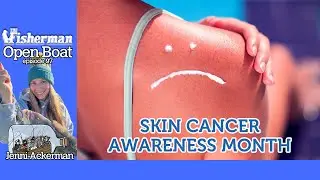 Skin Cancer Awareness Month ep. 97