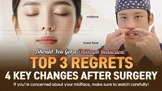 4 Changes After Philtrum Reduction & Top 3 Regrets