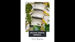 DISKUS HERNIJA VRATNE KIČME kiropraktika pomaže