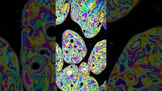 Люди думают, что это создано ИИ, но это всего лишь пузырь под микроскопом!