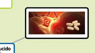 Riesgos m&eacute;dicos, f&iacute;sicos y psicol&oacute;gicos del aborto inducido.