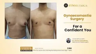 Gynaecomastia Treatment | Symmetrica | Dr Amit Kr Choudhary