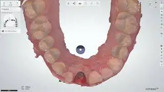 Swapping scan flags for the same implant system