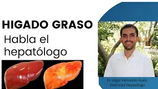 Hígado Graso, diagnóstico y manejo
