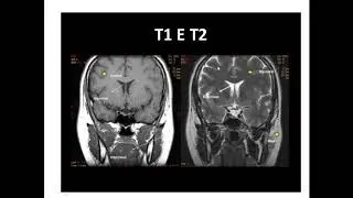 Radiologia: Questões para concurso Parte 2
