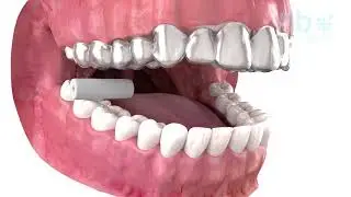 Ortho Ease - Retrievers and Chewies.