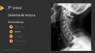 Guía para interpretar una radiografía de columna