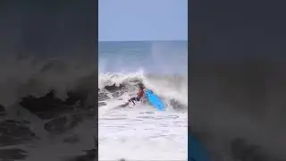 Worst Surf Accident! #shorts #surf #surfing #accident #kook