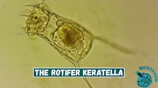 A beautiful rotifer of the genus Keratella