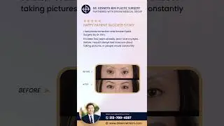 Dr. Kim's Double Eyelid Surgery & Ptosis Correction|Transformation Testimonial #doubleeyelidsurgery