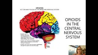 Naloxone for Opioid-Induced Respiratory Depression