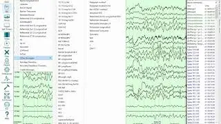 EEG Average Reference Persyst 14