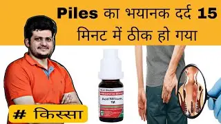 piles के भयानक दर्द को कैसे जल्दी ठीक करें ? Homeopathic Medicine | Acid Nitric 1000 |