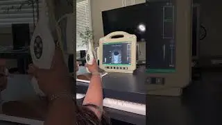 Ultrasound guided PIV simulation #ultrasoundguidance #ivinsertion #vascularaccess