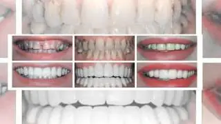 Smiles of Bellevue | Dentist in Bellevue WA