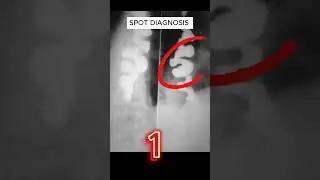 X ray quiz 37 #nursing #nursingstudent #doctor #USMLE  #MBBS, #hospital #anatomy  #ctscan #radiology