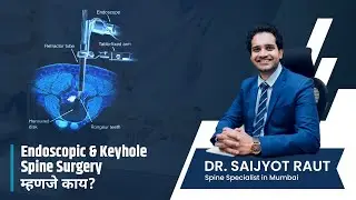 Endoscopic & Keyhole Spine Surgery म्हणजे काय? | Endoscopic & Keyhole Spine Surgery Explained