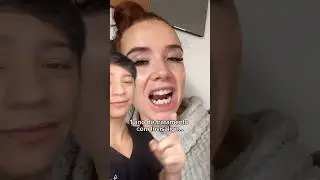 Ela gravou todo o tratamento com o Aparelho Invis&iacute;vel e o  Resultado&hellip;#shorts