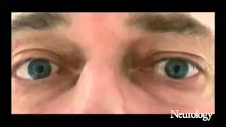 The takeaway Frenzel goggles