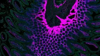 SDDRC - Classical staining techniques and multiplex immunofluorescence