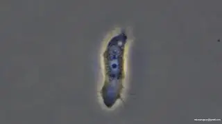 Ameba desconocida segundo video Squamamoeba? - unknown amoeba second video Squamamoeba?