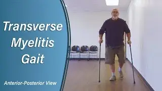Transverse Myelitis Gait - Case Study 10 (Anterior-Posterior)