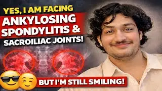(Hindi) Yes, I am facing ankylosing spondylitis and sacroiliac joints with a smile 😊😎