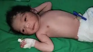 Baby ab thik ho gya hi #trading #virababy #cutebaby #newborn #youtube #nursingvideo #mbbs