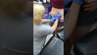 Hip dermals