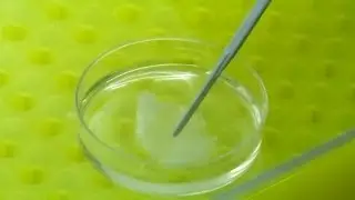 AS Researchers from Granada create artificial skin using stem cells to treat large burns