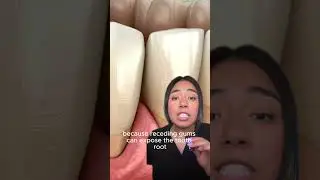 What is a gum graft?