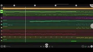 The source of my music, the beloved FL Studio Mobile, #music #flstudiomobile #flstudio