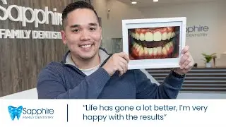 I'm Happy with the Results of the Sapphire Clear Smile Aligners - I'm No Longer Self-Conscious