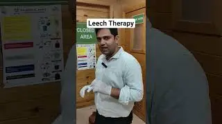 Leech Therapy Benefits Explained