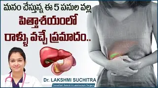 పిత్తాశయంలో రాళ్ళుకి కారణాలు| 5 Risk Factors of Gallstones | Gall Bladder Stones | Sankhya Hospitals