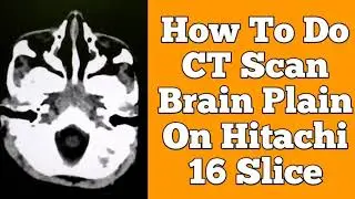 How to do CT scan brain plain on Hitachi 16 slice