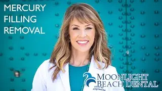 Mercury Filling Removal in Encinitas
