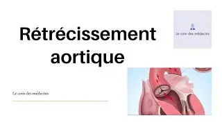 Rétrécissement aortique