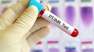 PT INR Test by ERBA ECL 105#labtested #laboratory #bhubaneswar