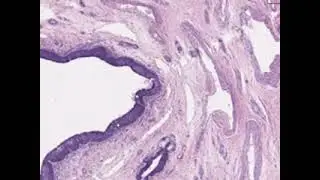 male urethra
