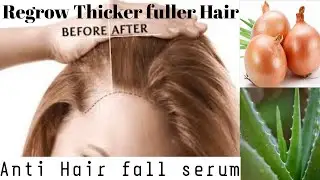 Anti Hair fall Serum| Hair Regrow Onion Serum make hair thicker and fuller  |Meena's Remedy