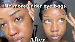 HOW I BRIGHTENED MY DARK CIRCLES!! SIMPLE AND EFFECTIVE ROUTINE (Pictures included)