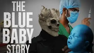 &ldquo;Blue Baby Syndrome &mdash; The Newborn Who Turned Blue | Real Medical Story by a Medical Student&rdquo;