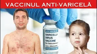 VACCINUL ANTI-VARICELA pentru  COPII si ADULTI