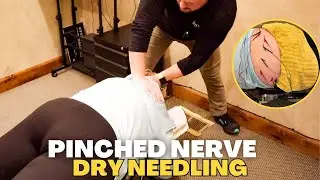 *INSANE* Low Back Adjustment Pinched Nerve & Dry Needling ASMR