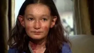 Celebrities lend support to girl with agonising skin condition | 5 News